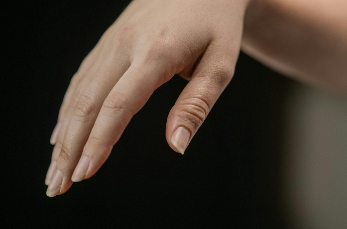 Ongle blanc : Causes, prévention, traitements
