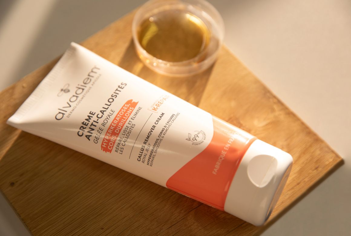 Callosités sur les pieds : prévention et traitement