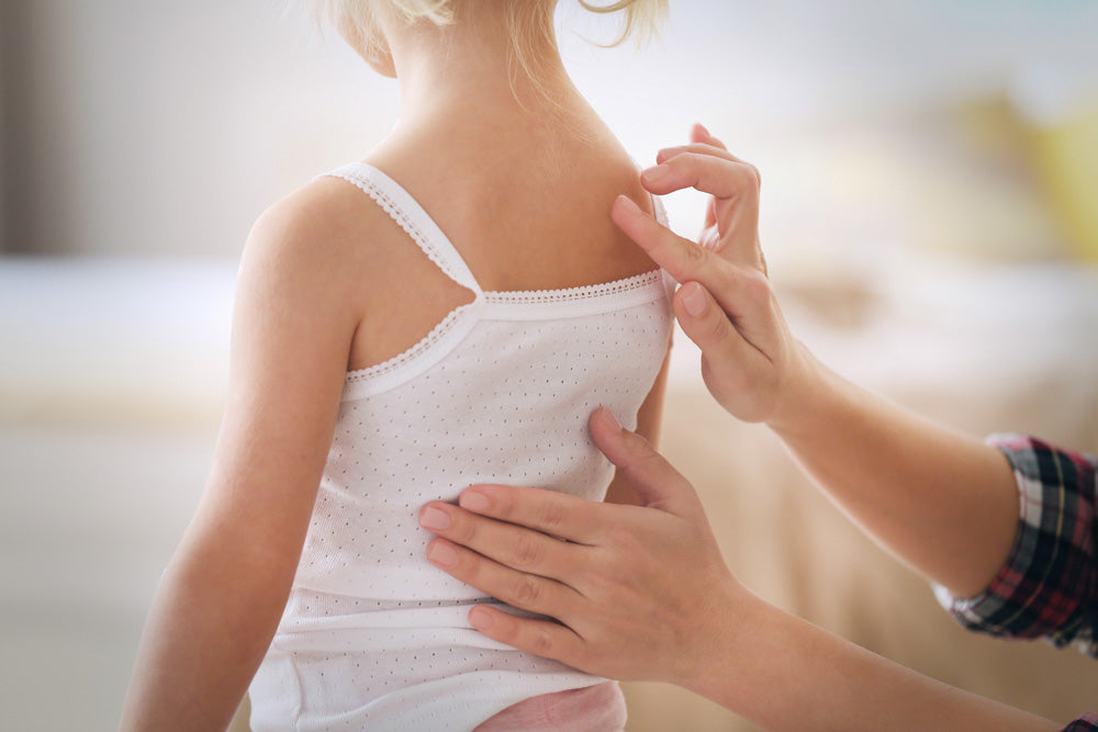 Mon enfant a la peau irritée en hiver, que faire ?