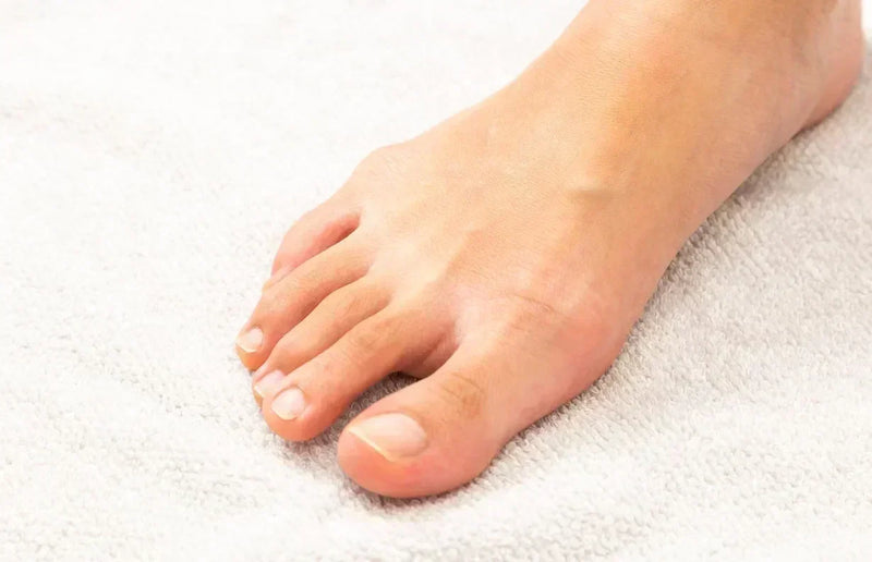 Douleur à l'ongle du gros orteil 
