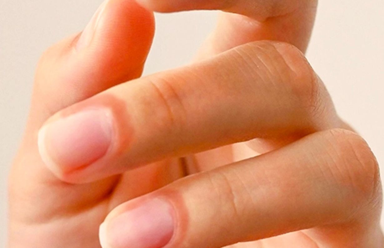 Psoriasis de l'ongle