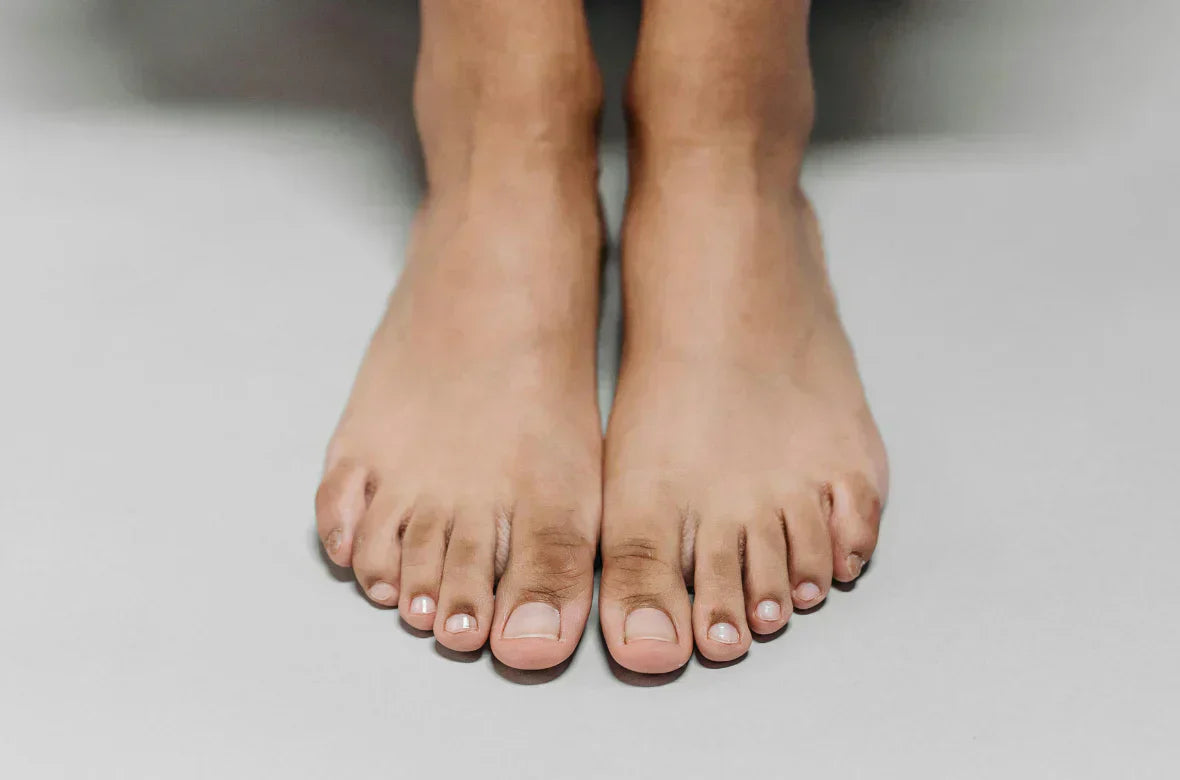 Mycose ongle de pied : traitement efficace et rapide