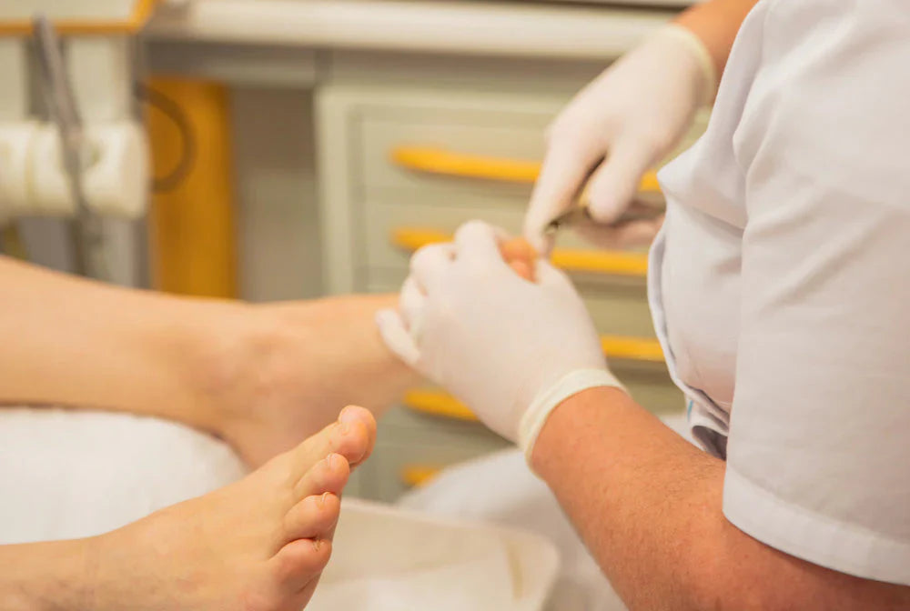 Mycose sur les ongles de pied : que faire