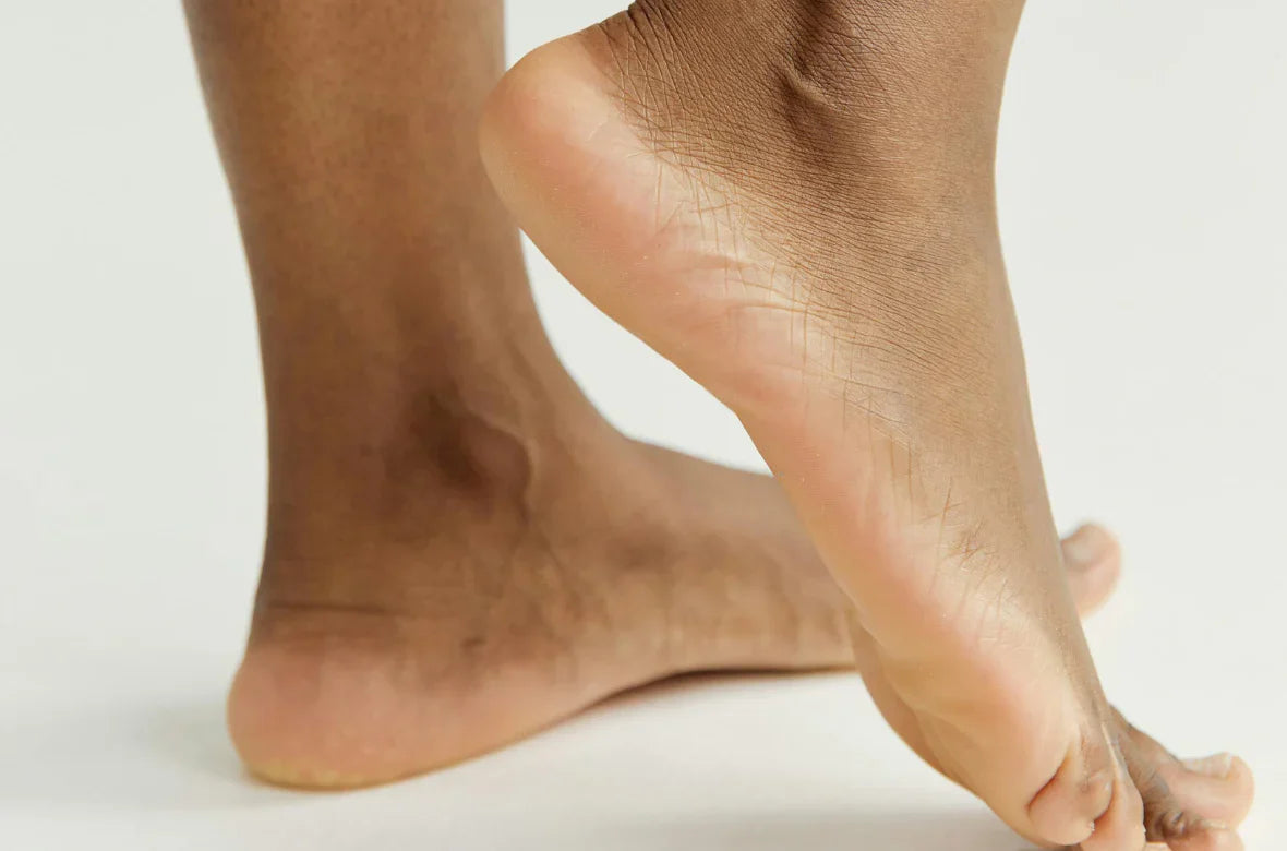 crevasses au pied douloureuses traitement