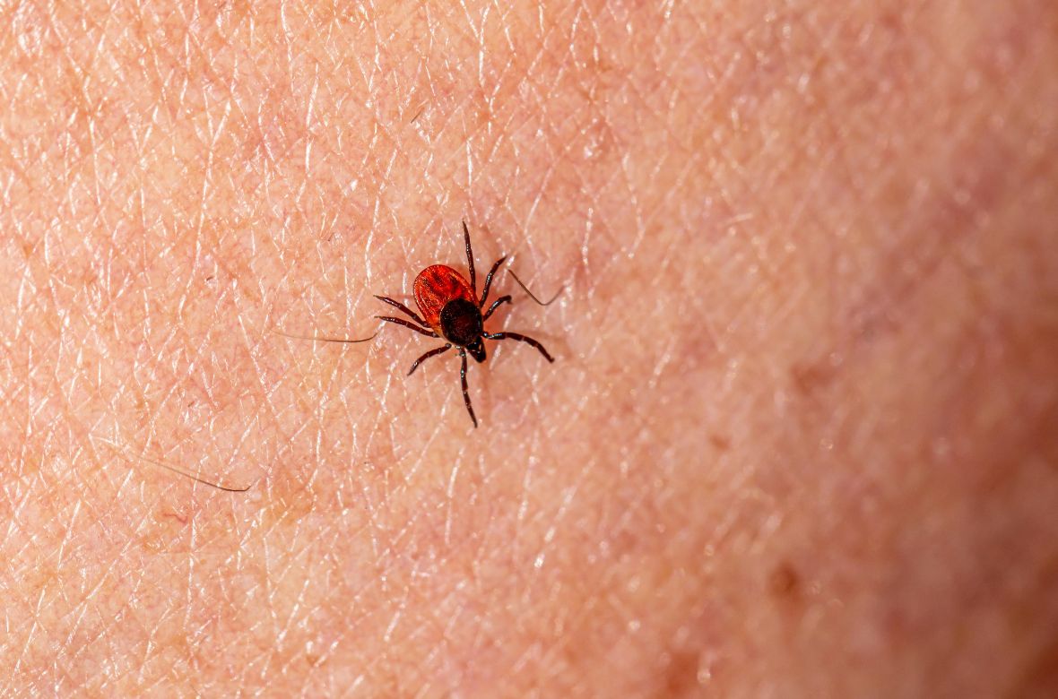 Piqûres d'insectes