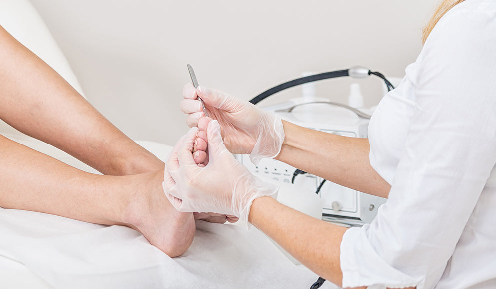 Ongle incarné au pied : qu'est ce que c'est?