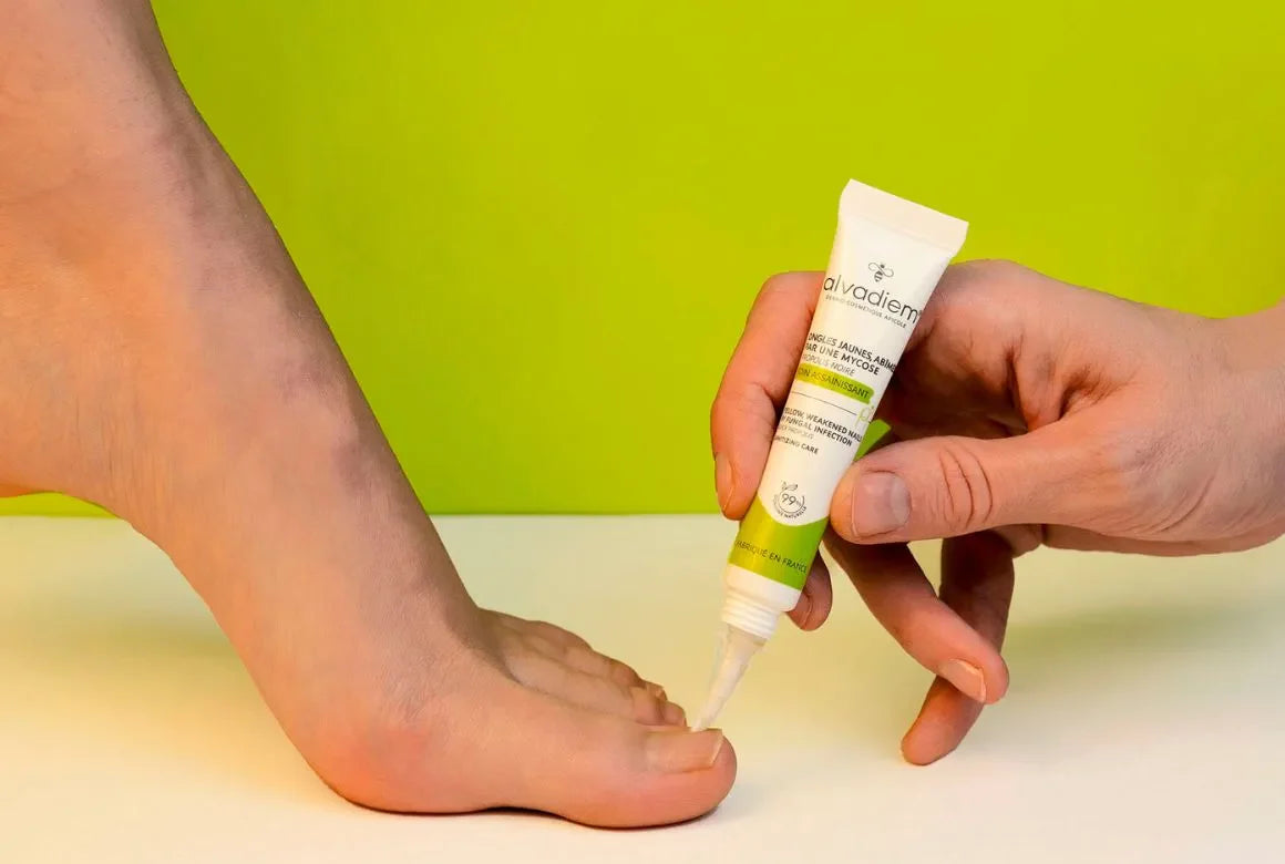 Soins pour ongles jaunes et abîmés