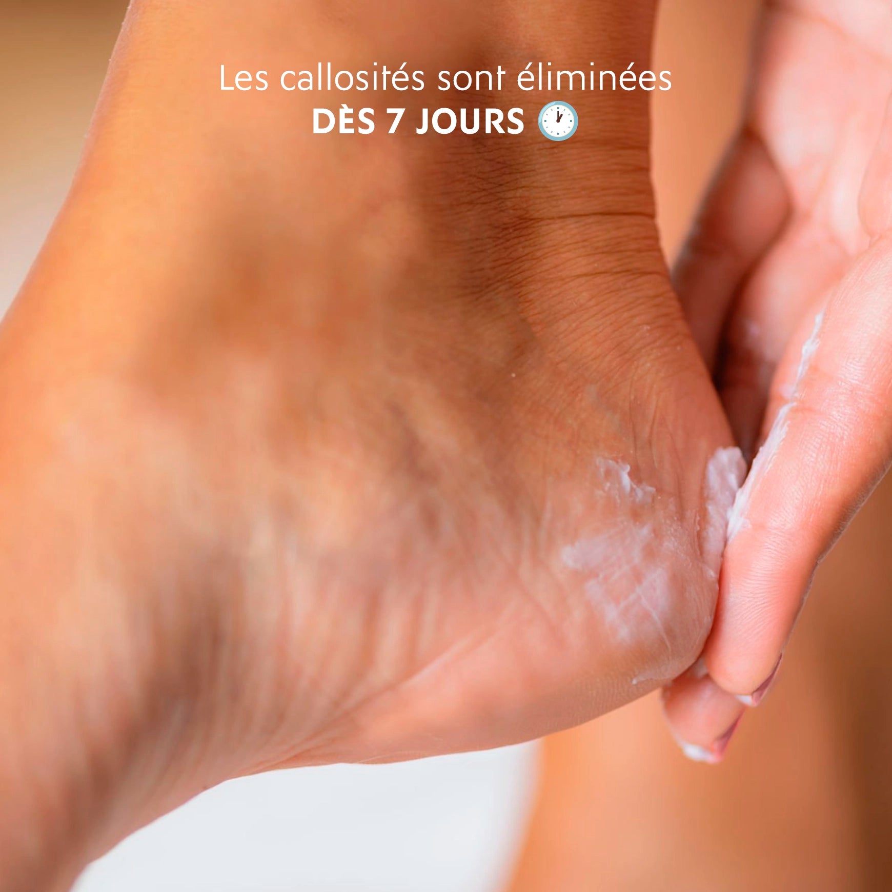 Crème Anti-Callosités
