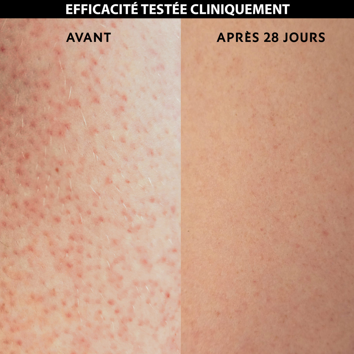 Fluide Corps Anti-Rugosités Keratolia+