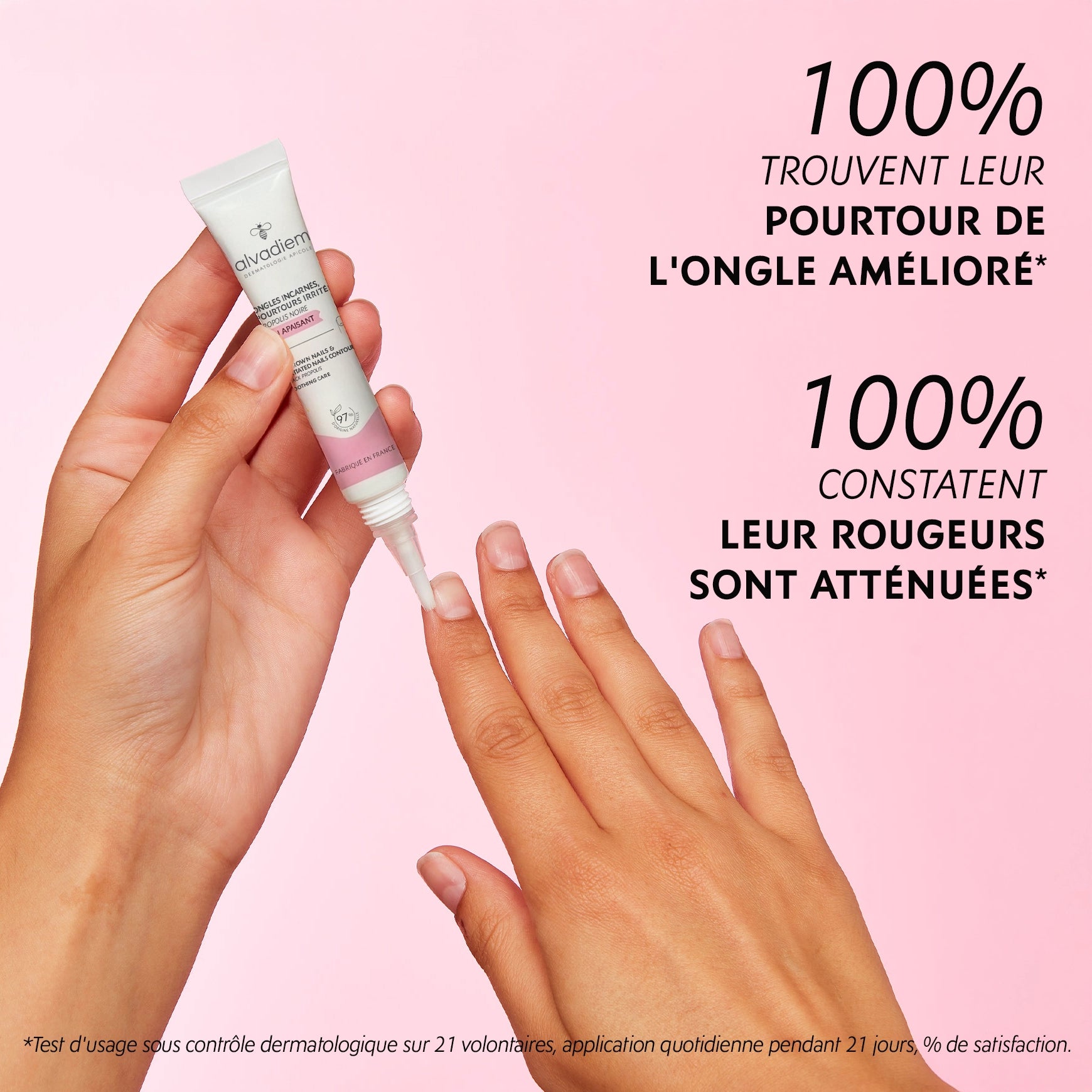 Pourtour ongles sensible et irrité