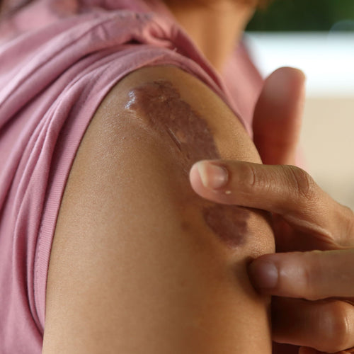 Baume Réparateur Cicatrimel