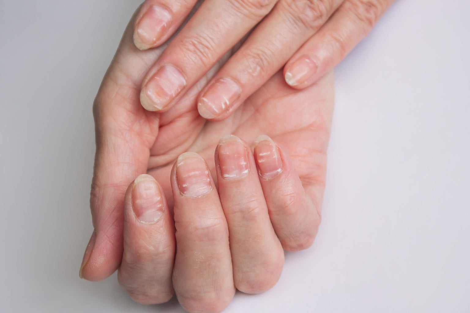 Soins naturels pour les pieds — photo illustrative